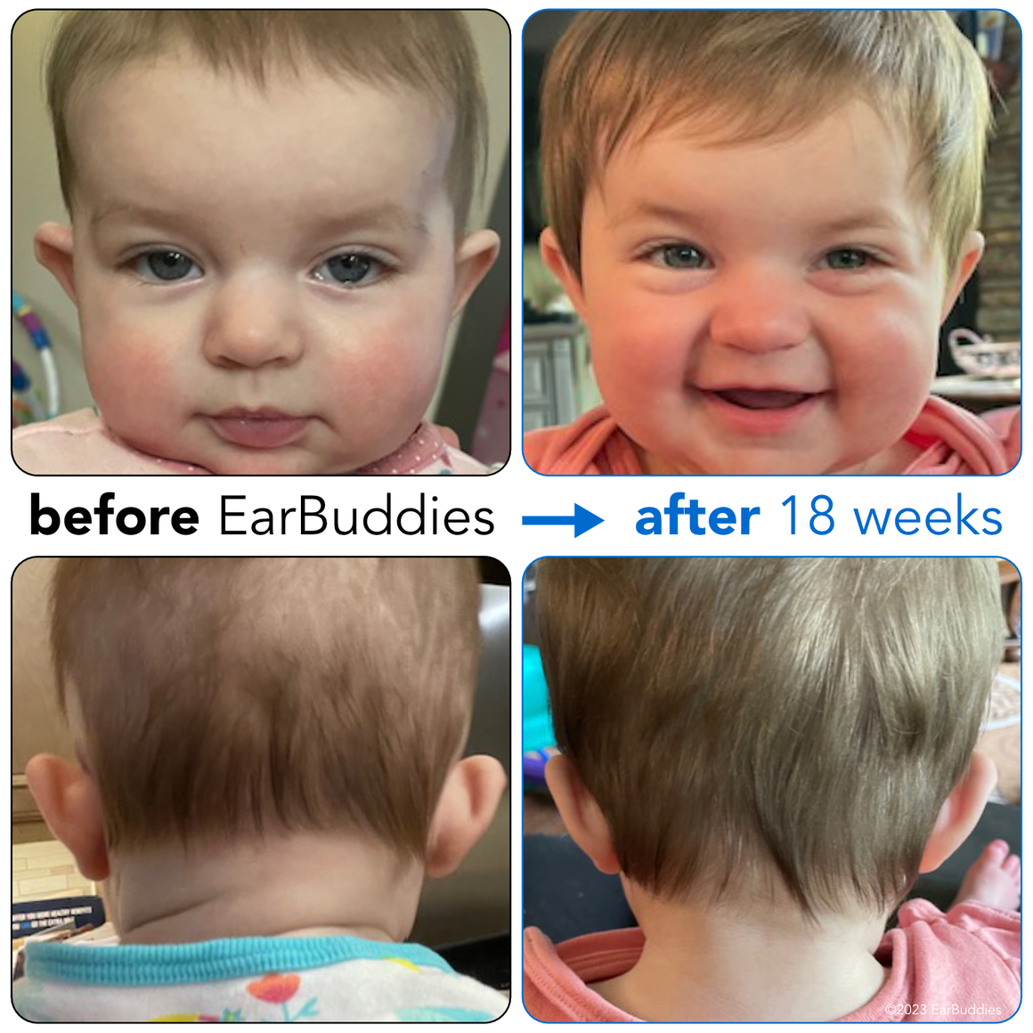 baby elfin ears, sharing my expereince using earbuddies(TM) on my baby